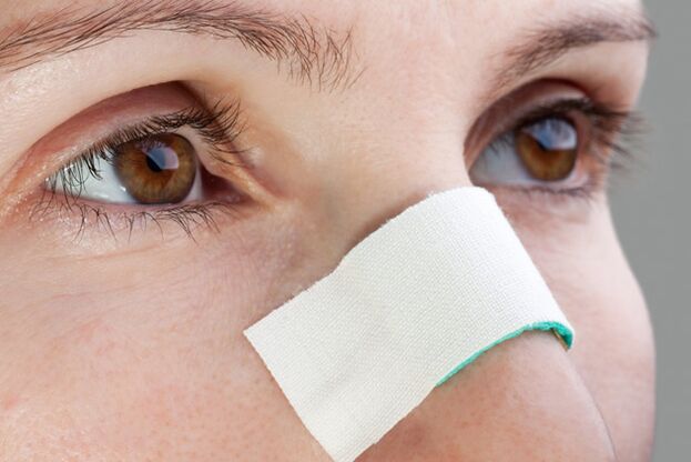 Nazal septumun düzeltilmesinin postoperatif döneminde olası komplikasyonlar